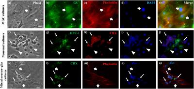 A Defective Crosstalk Between Neurons and Müller Glial Cells in the rd1 Retina Impairs the Regenerative Potential of Glial Stem Cells